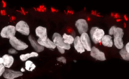 A microscopic view of brain organoids 